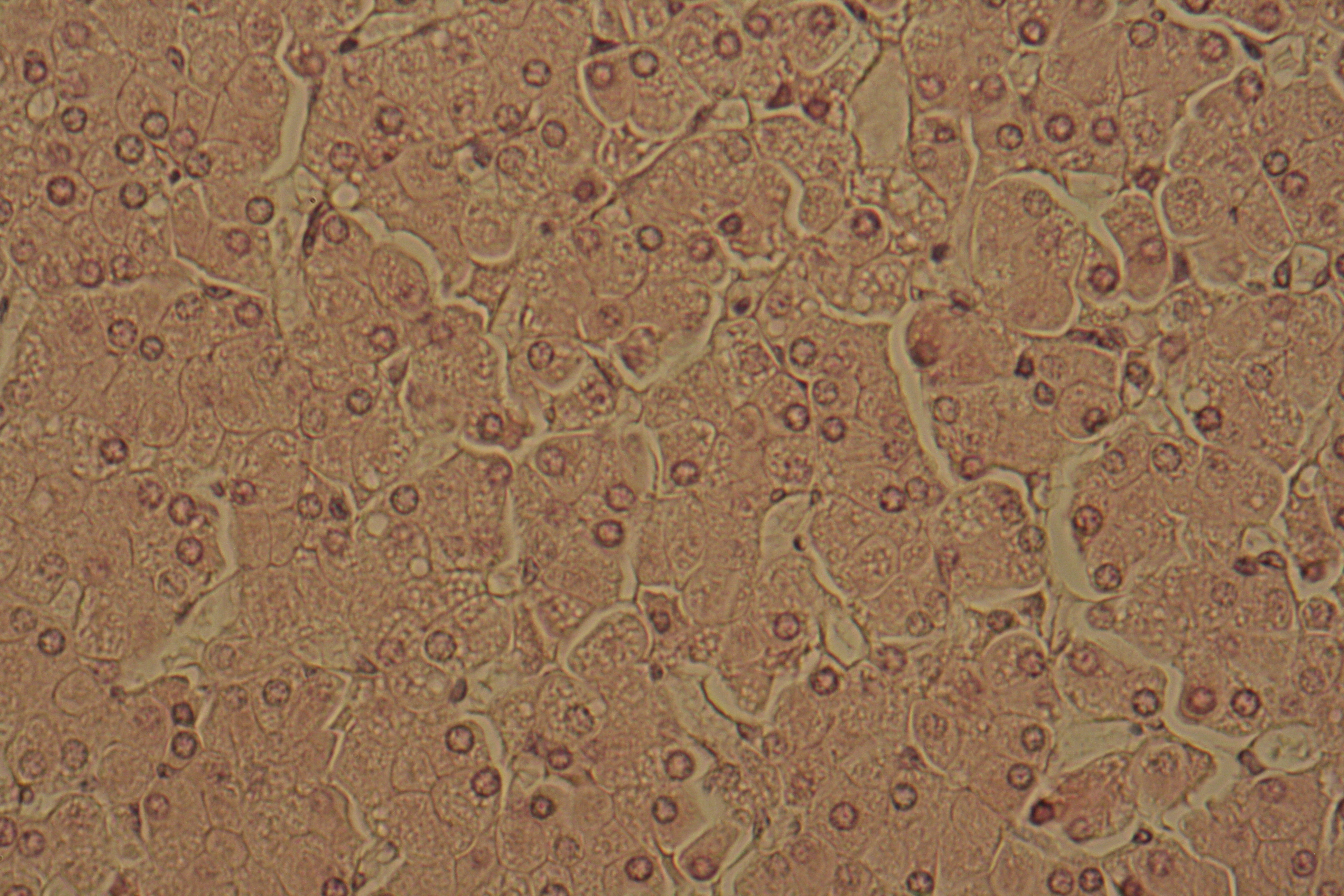 adrenals with smooth er
