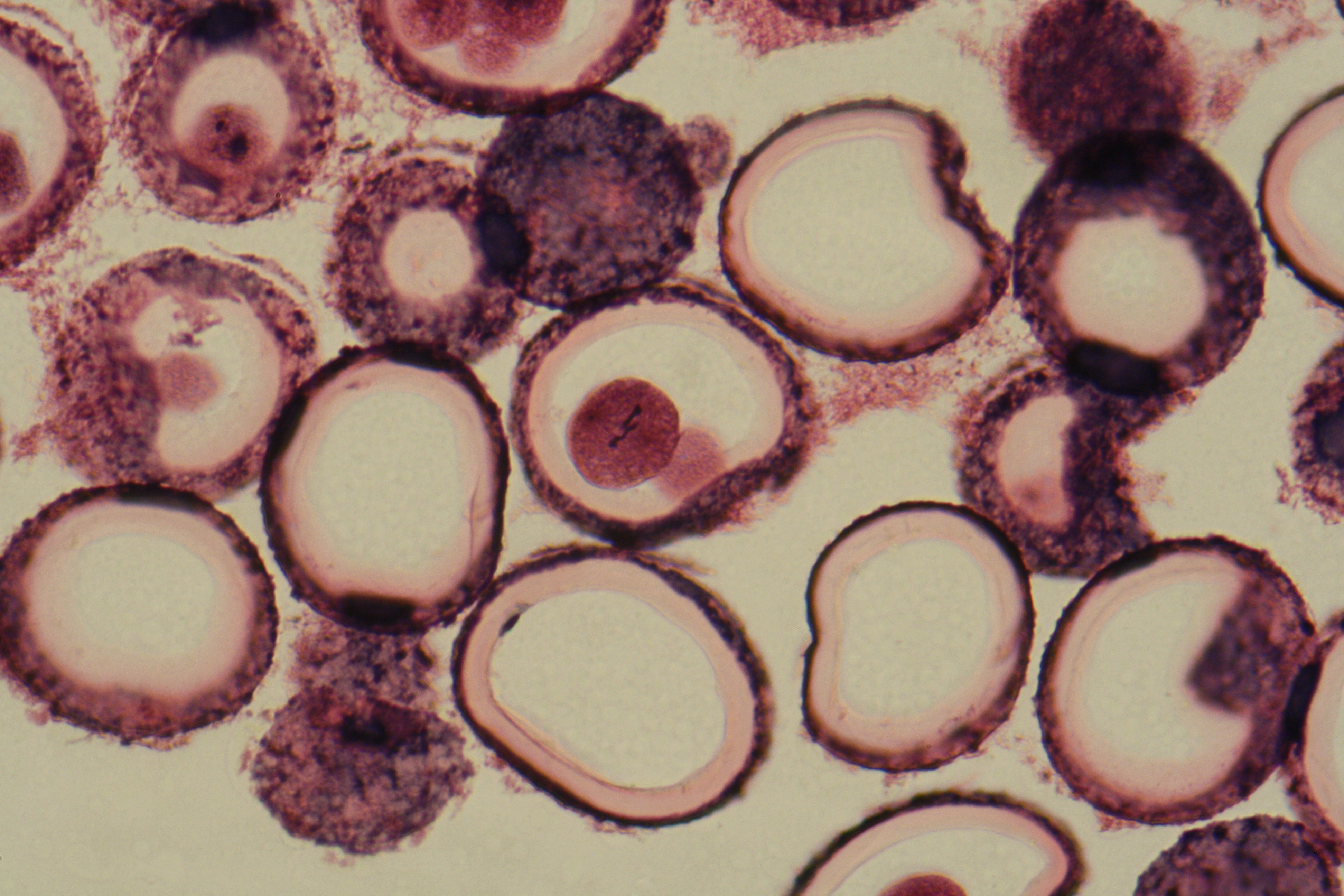 ascaris with asters and centrioles