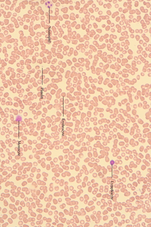 blood showing various cell types-1