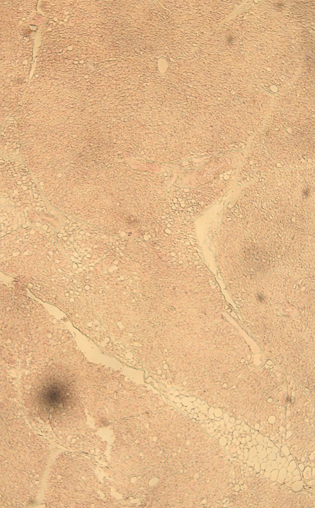 brown adipose tissue