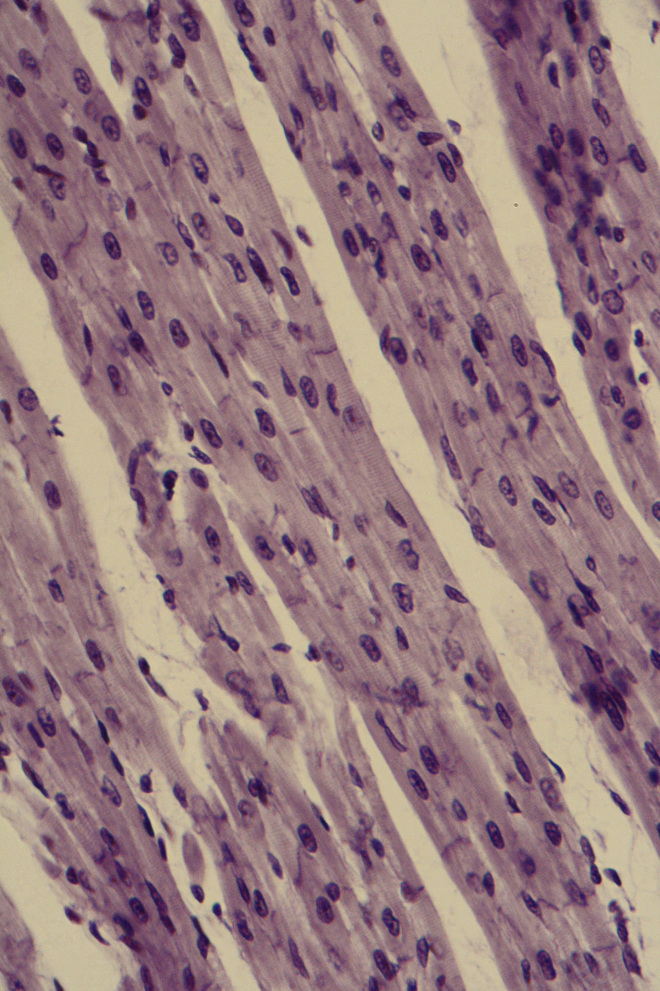 cardiac muscle with intercalated disks