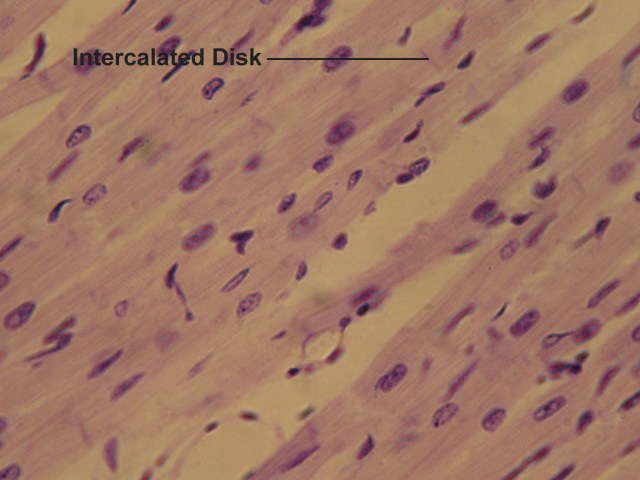 cardiac muscle