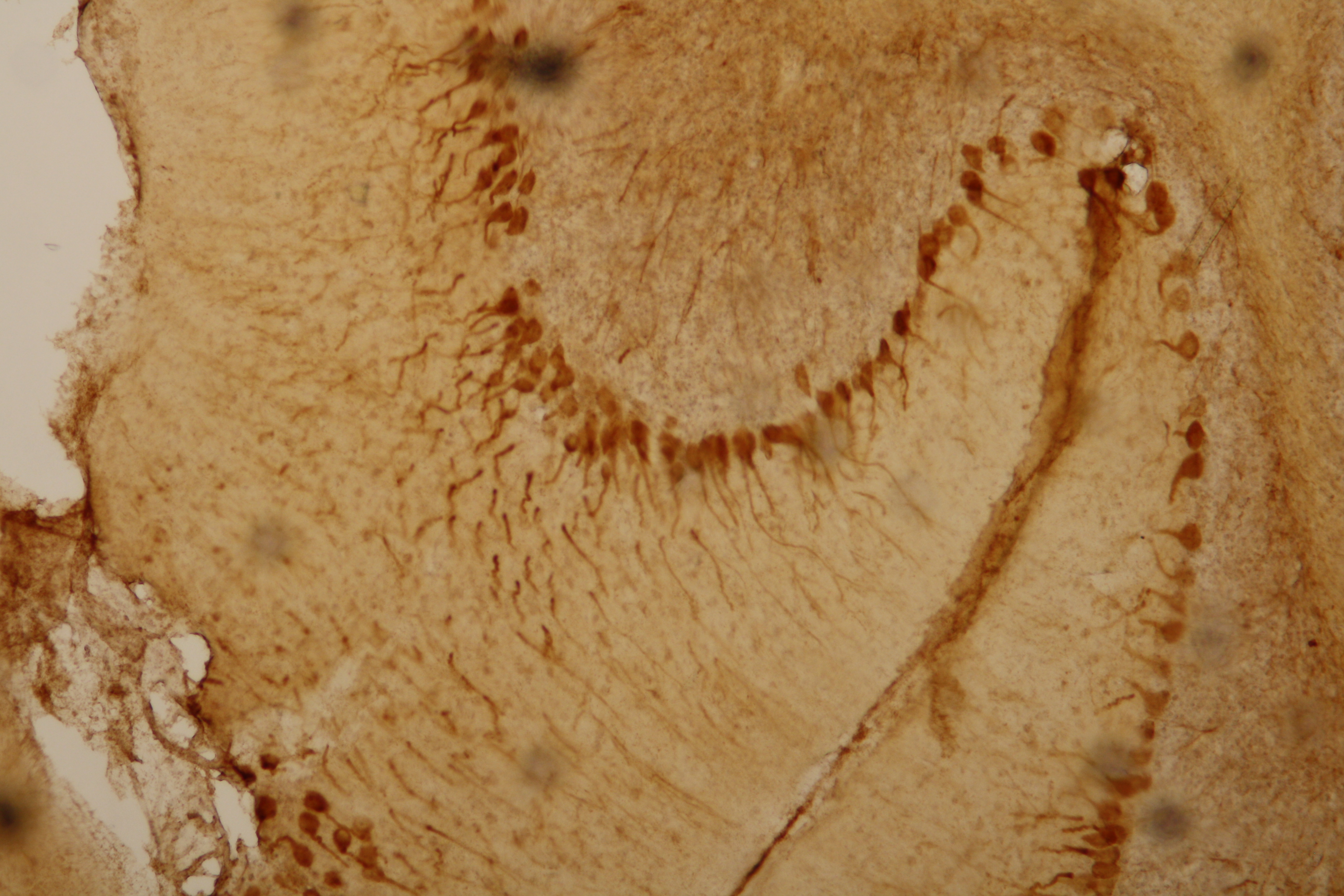 cerebellum with cytoskeletal filaments