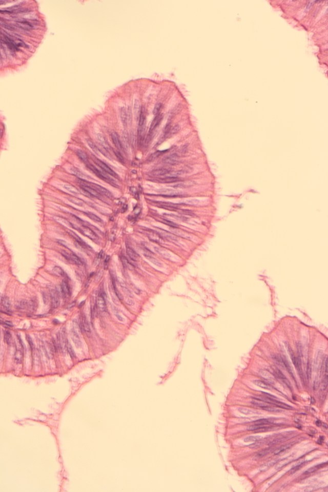 ciliated columnar epithelium