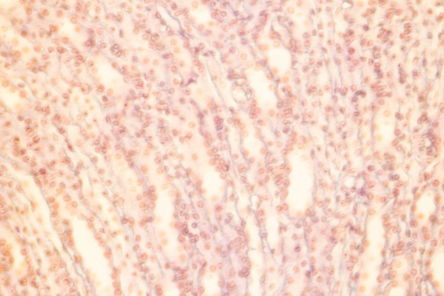 cuboidal epithelium-1