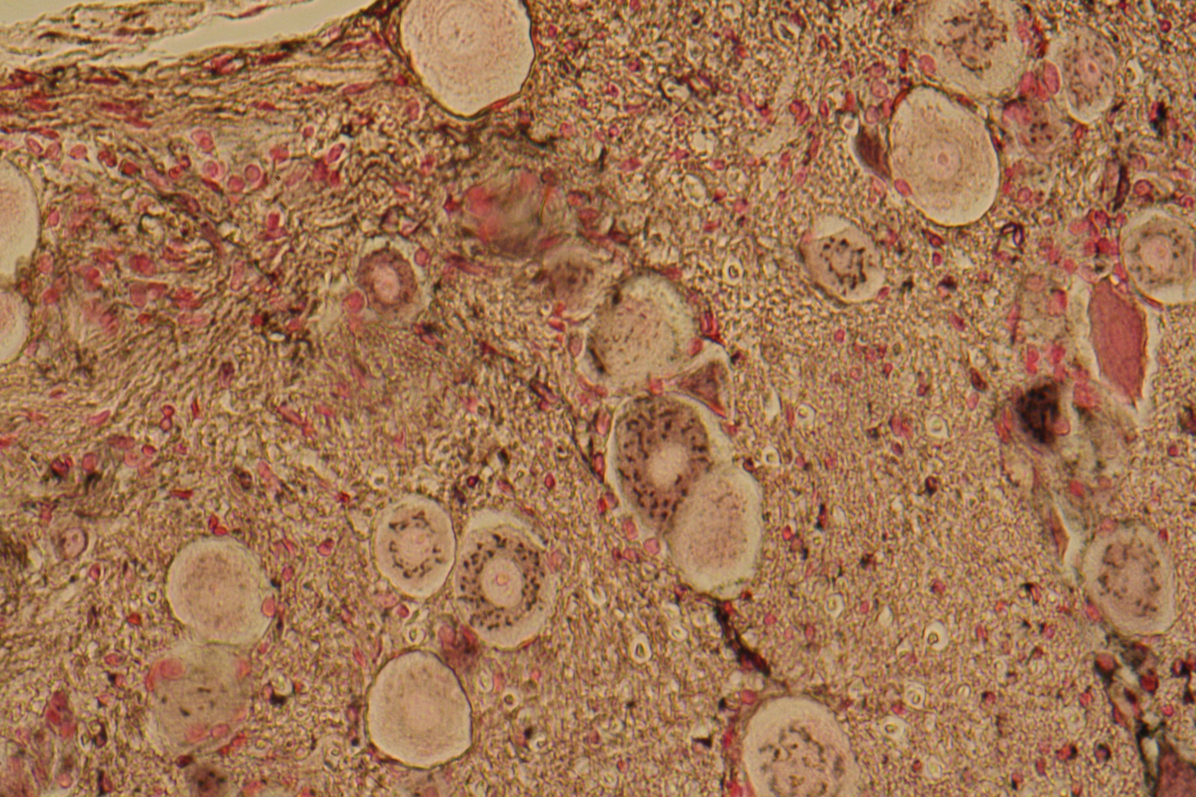 dorsal root ganglion with golgi