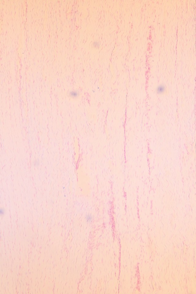 fibrous (dense) connective