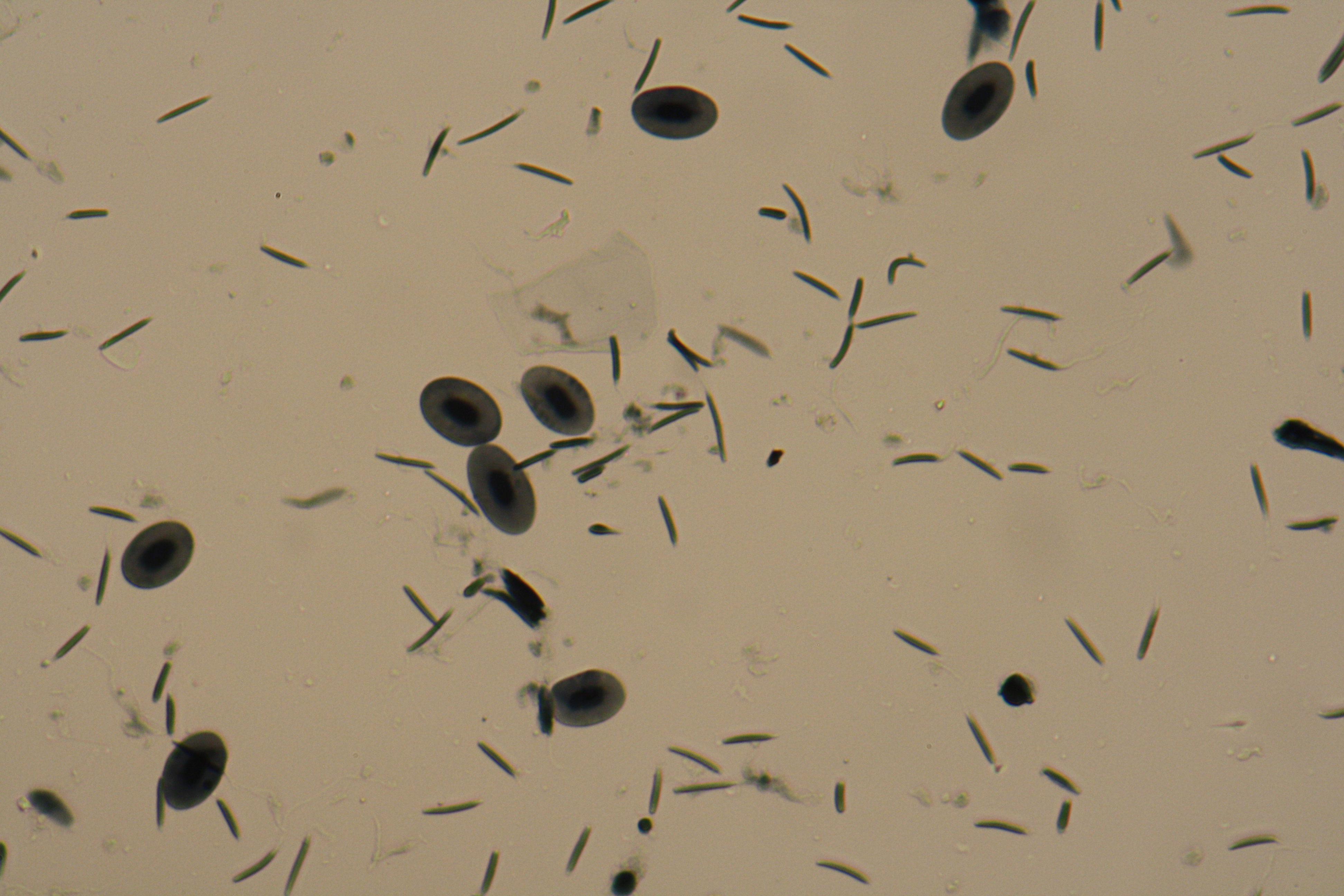 frog sperm with flagella