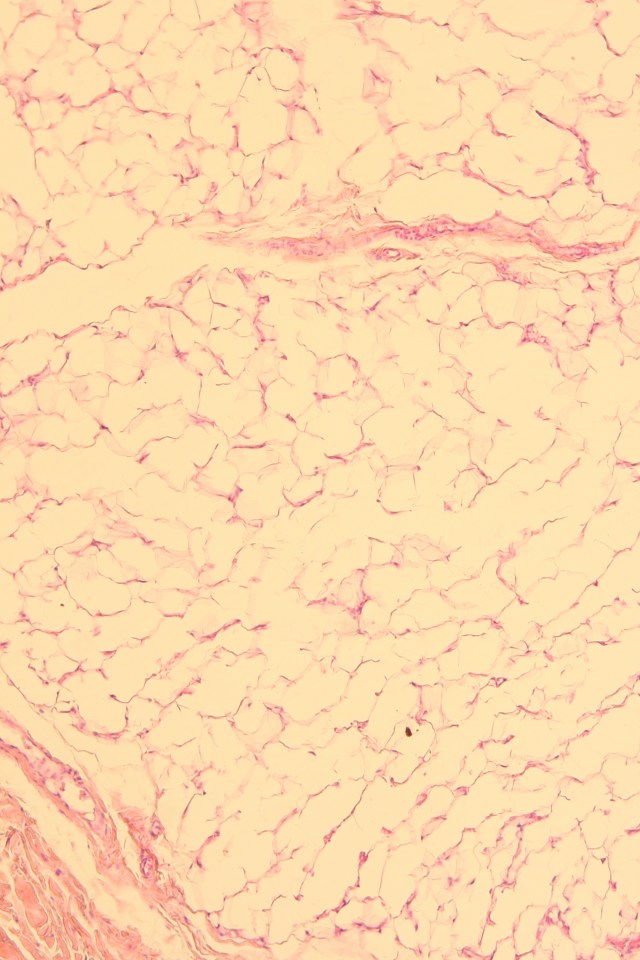 human adipose tissue
