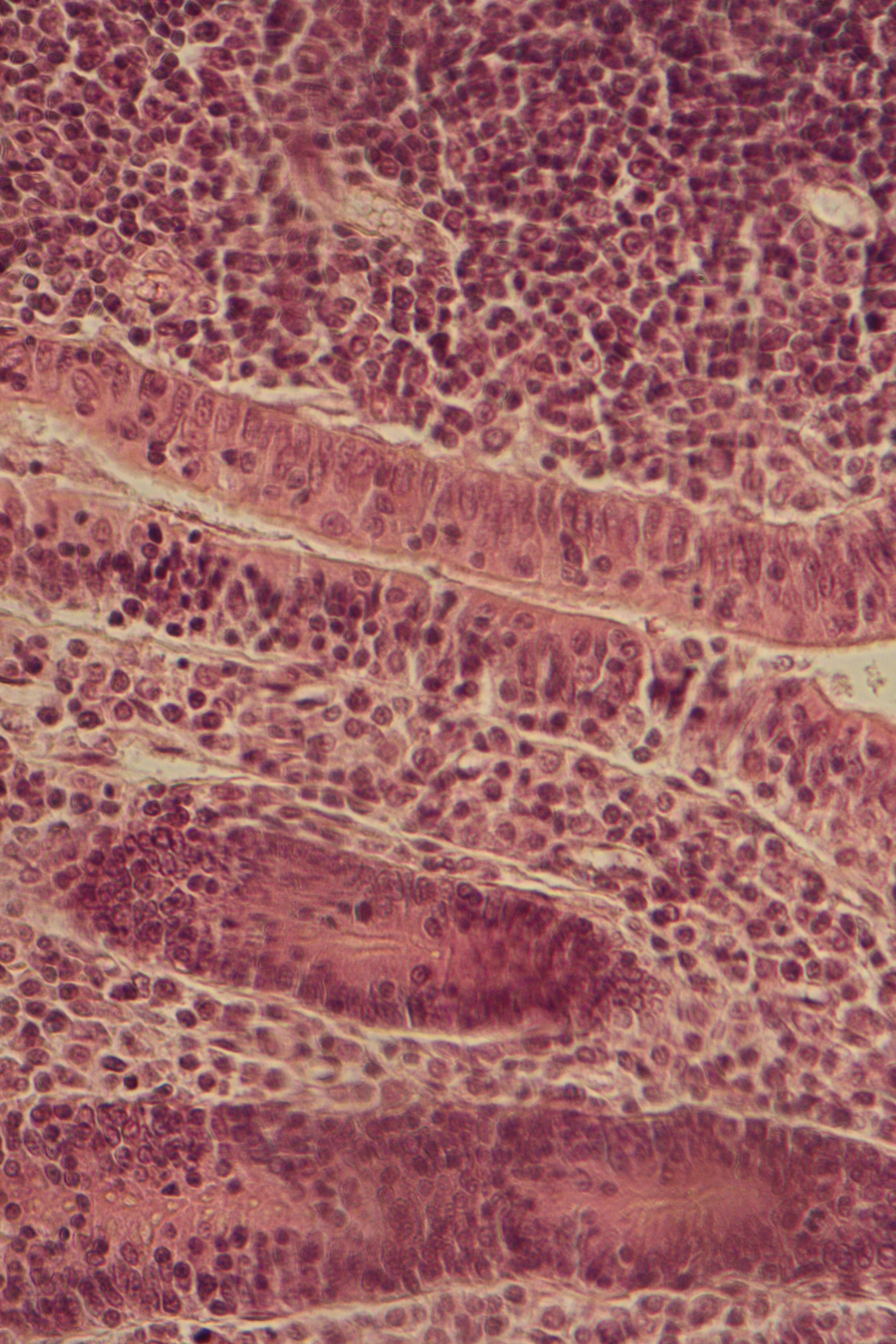 ileum with desmosomes