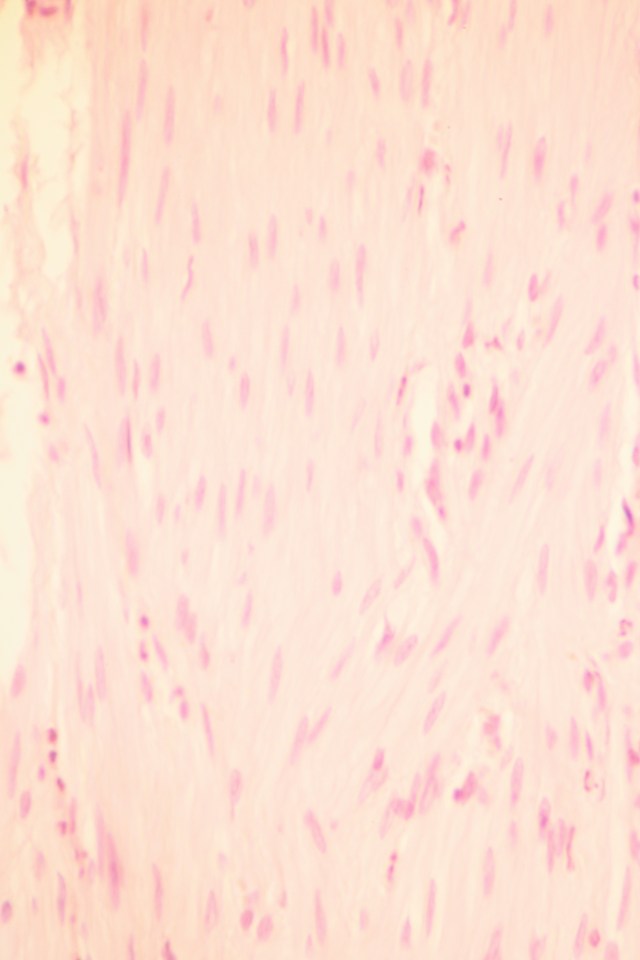 intact smooth muscle