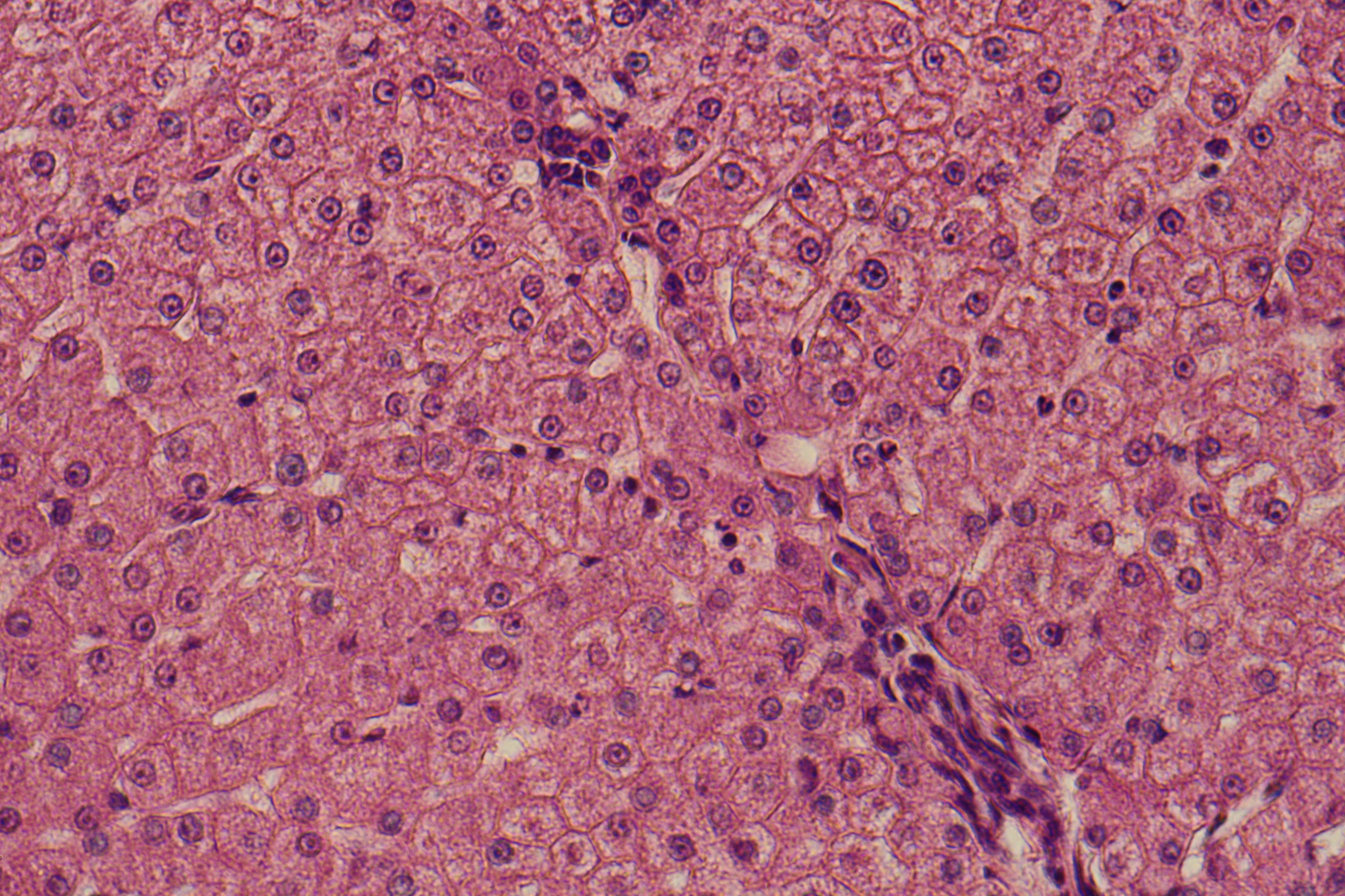 liver with lysosomes