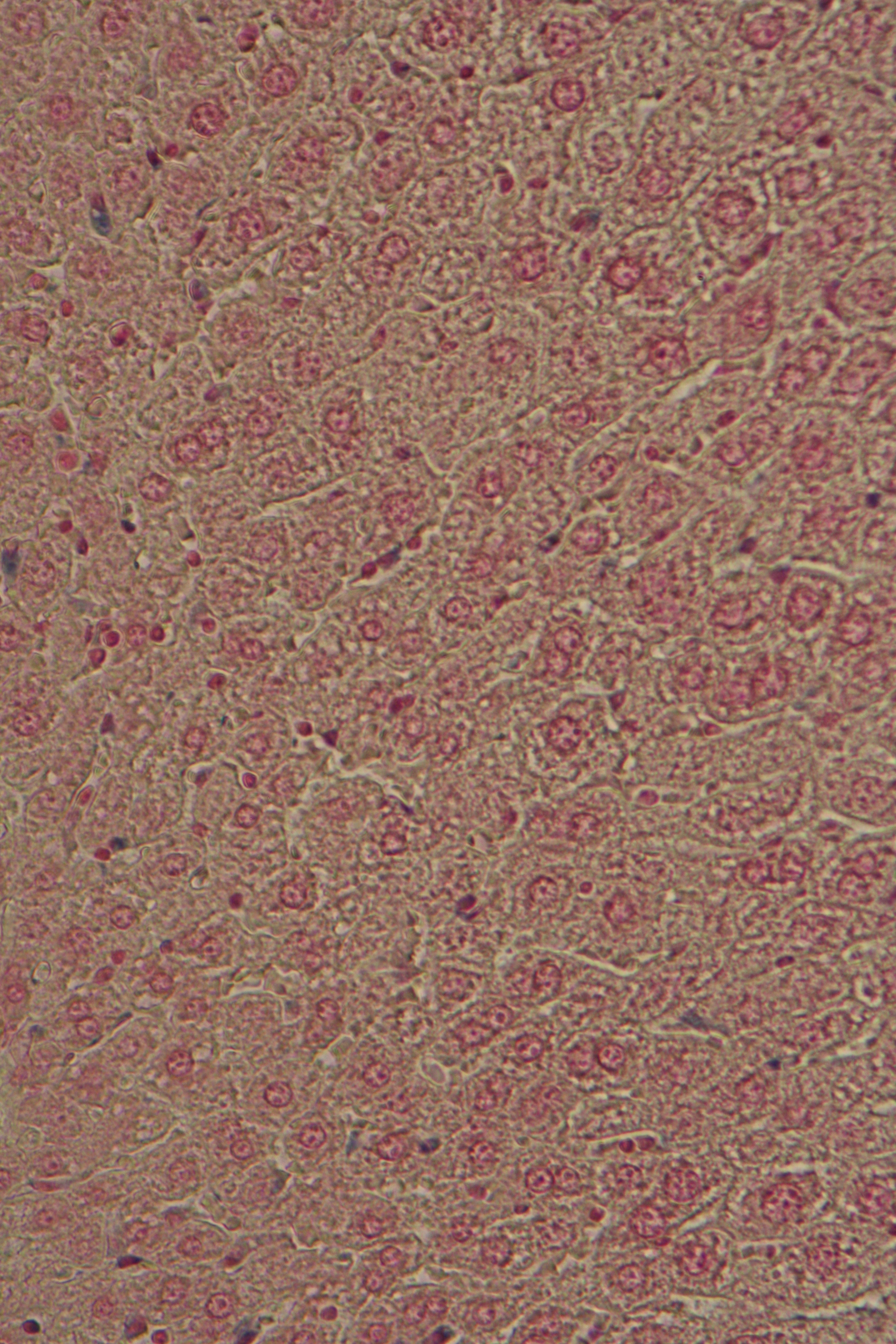 liver with macrophages with endocytotic vesicles