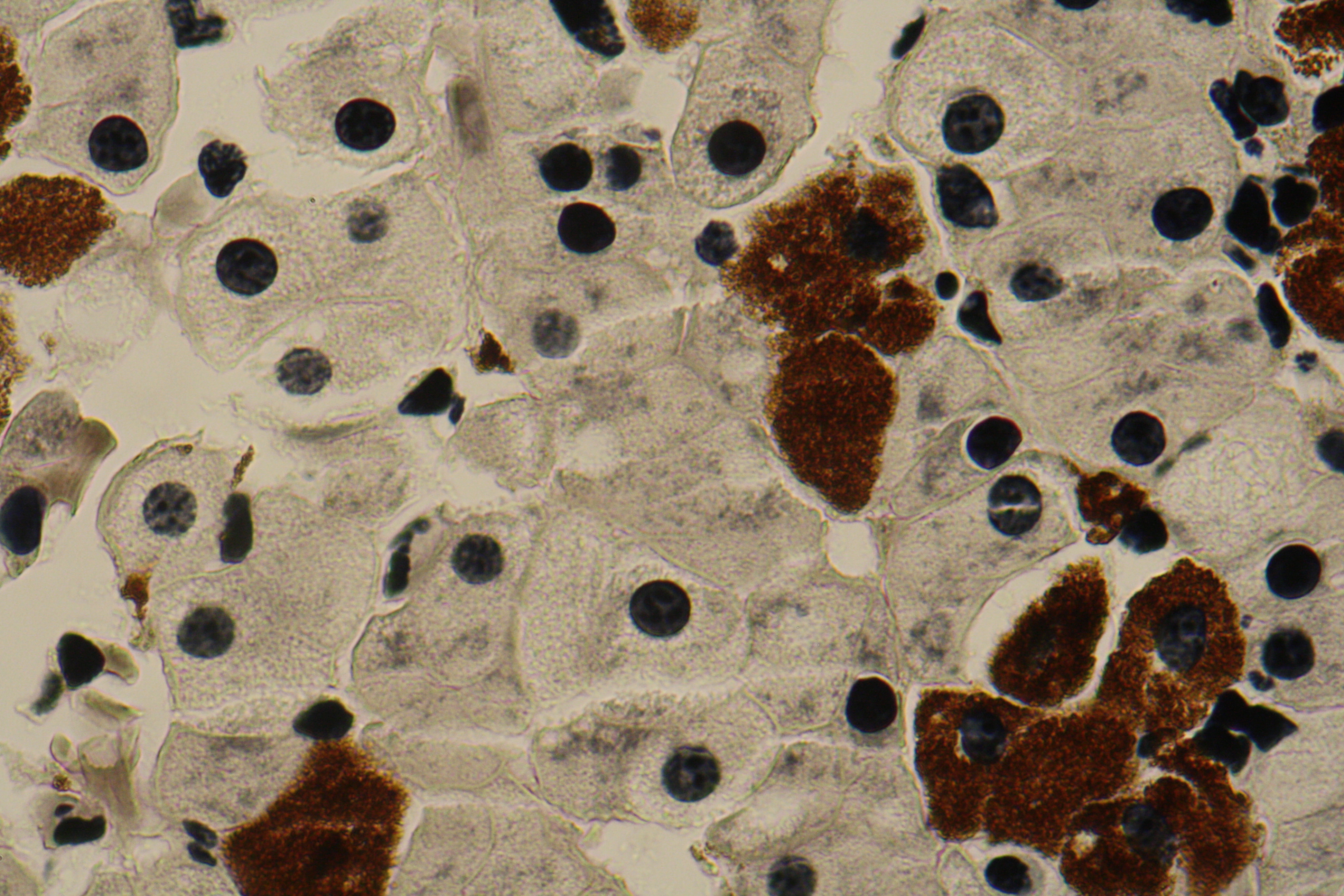 liver with mitochondria