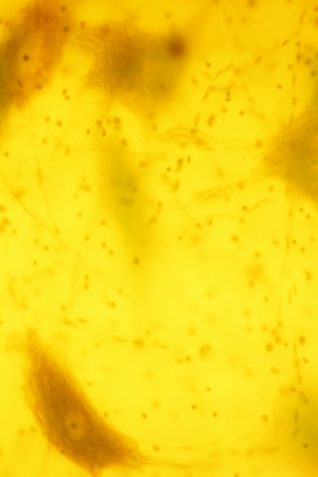 mammal motor nerve cells (yellow fluorescent imaging)