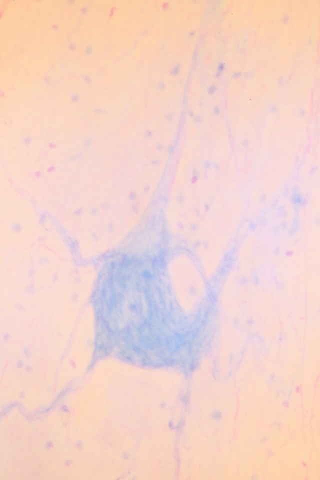 multipolar neurons (high power)