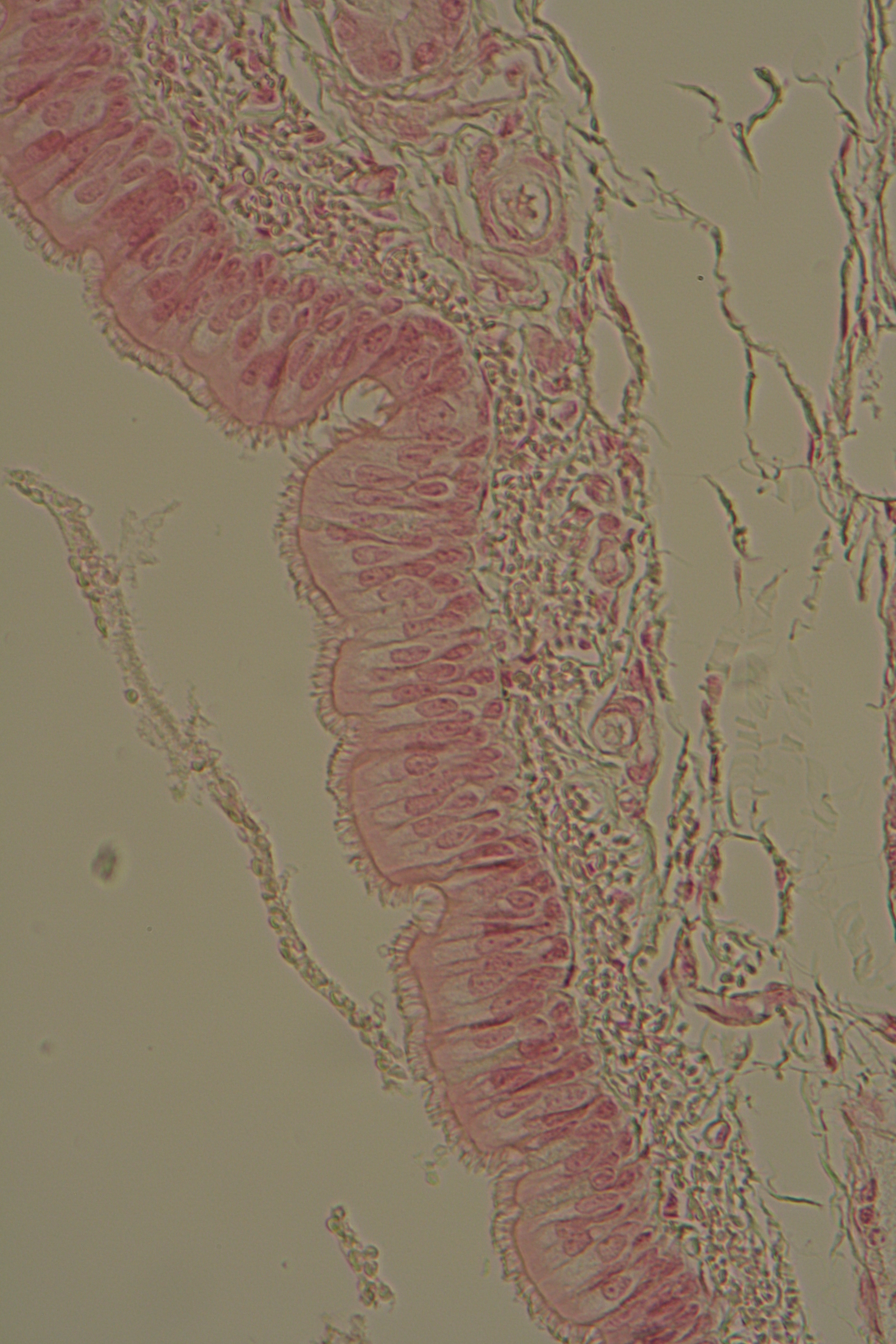 pseudostratified columnar ciliated epithelium