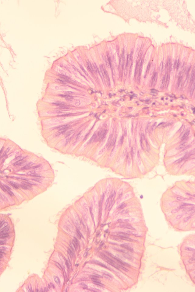 simple ciliated columnar epithelium