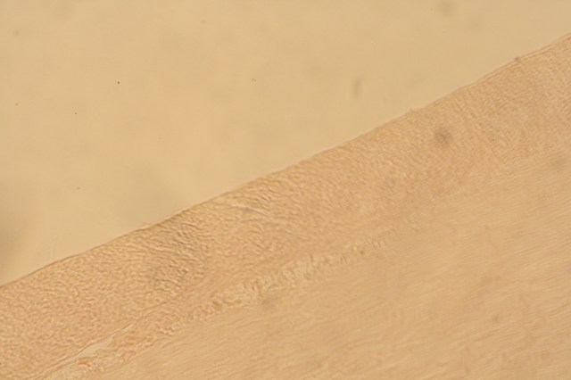 simple squamous epithelium (layer at very top of tissue)-1