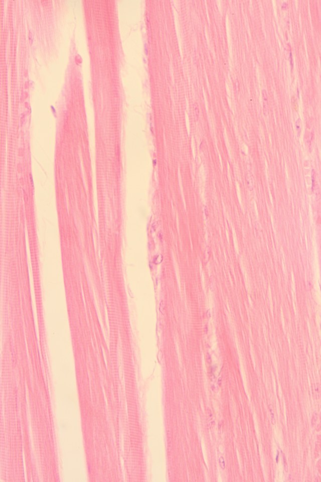 skeletal (striated) muscle