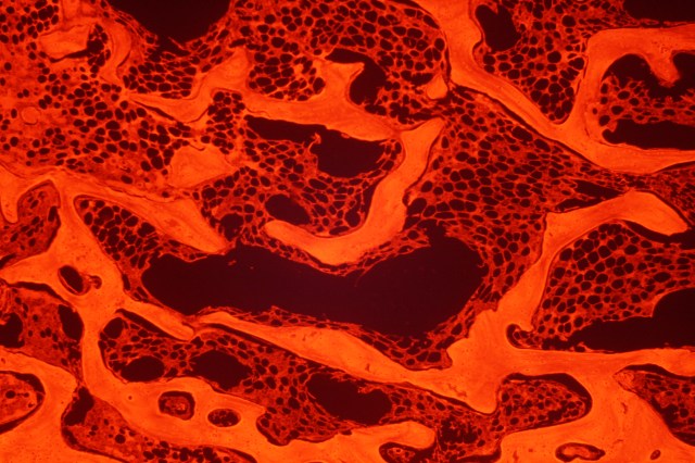 spongy bone under red fluorescence