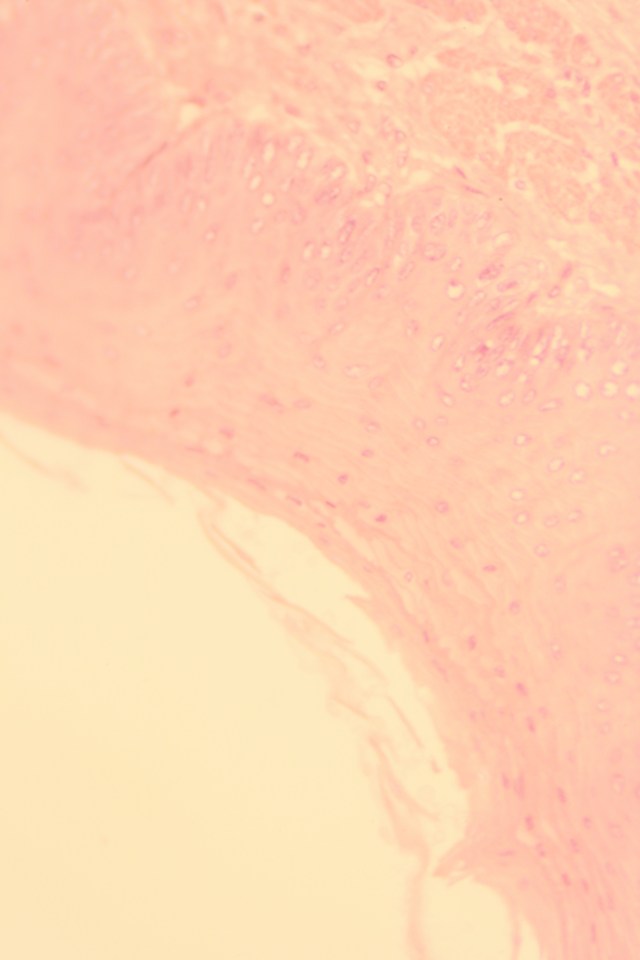 stratified squamous epithelium (bottom right of tissue sample)