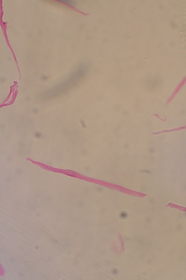 teased (separated) smooth muscle cells